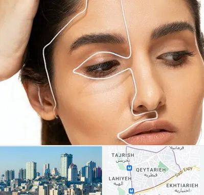 عمل بینی اقساطی در قیطریه 