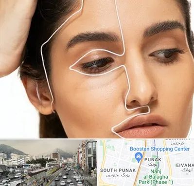 عمل بینی اقساطی در پونک 