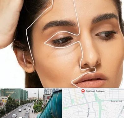 عمل بینی اقساطی در بلوار فرحزادی