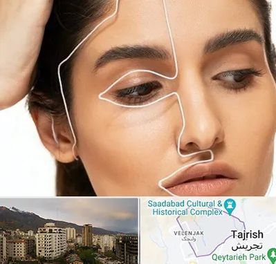 عمل بینی اقساطی در زعفرانیه 