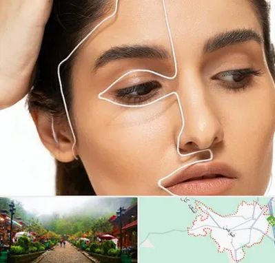 عمل بینی اقساطی در فومن