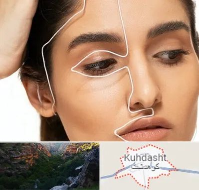 عمل بینی اقساطی در کوهدشت