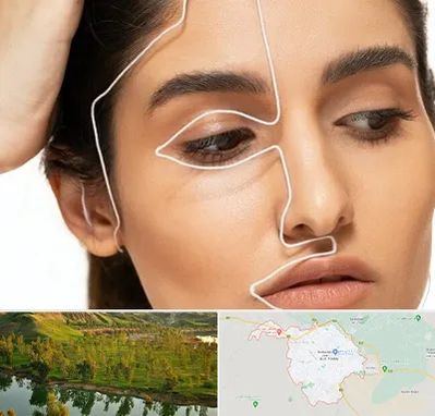 عمل بینی اقساطی در بهبهان