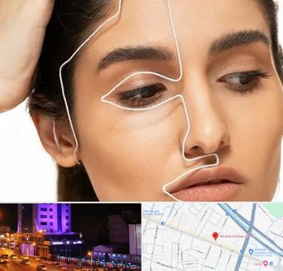 عمل بینی اقساطی در آبرسان تبریز