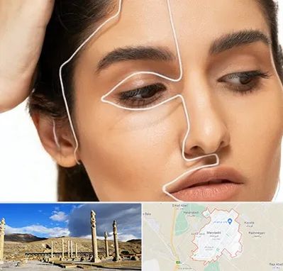 عمل بینی اقساطی در مرودشت