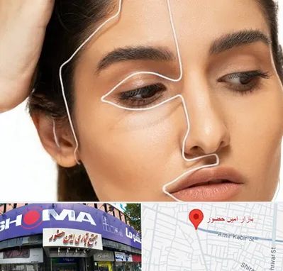 عمل بینی اقساطی در امین حضور