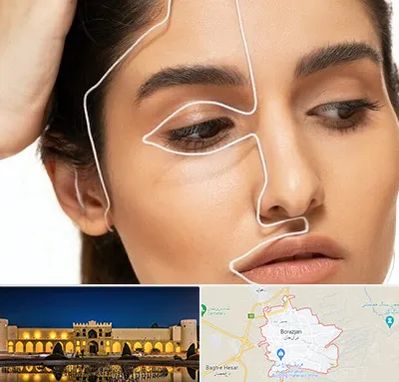 عمل بینی اقساطی در برازجان