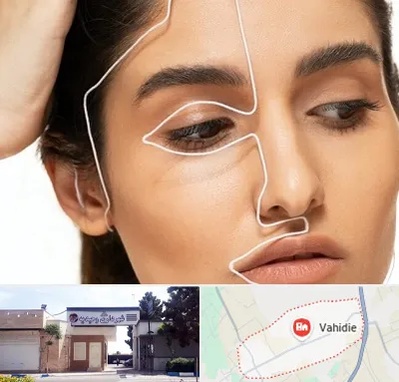 عمل بینی اقساطی در وحیدیه شهریار