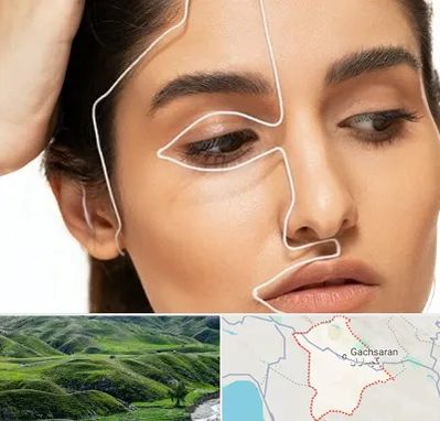 عمل بینی اقساطی در گچساران