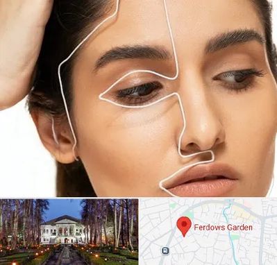 عمل بینی اقساطی در باغ فردوس