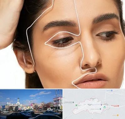 عمل بینی اقساطی در ماهدشت کرج 