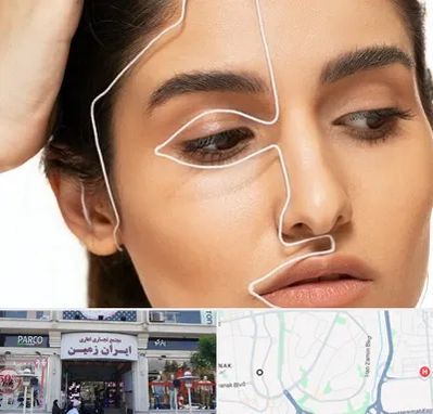 عمل بینی اقساطی در ایران زمین