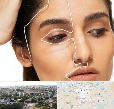 عمل بینی اقساطی در منطقه 20 تهران 