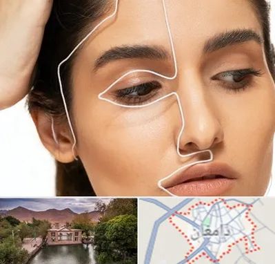 عمل بینی اقساطی در دامغان
