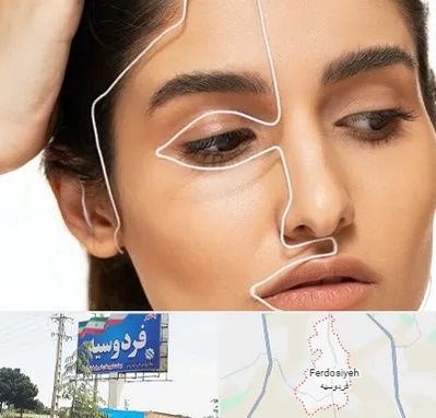 عمل بینی اقساطی در فردوسیه شهریار