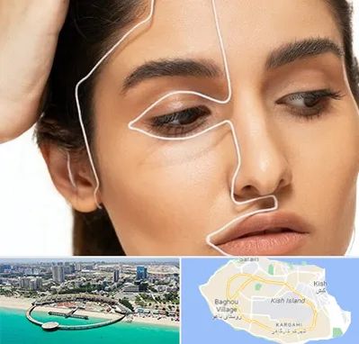 عمل بینی اقساطی در کیش