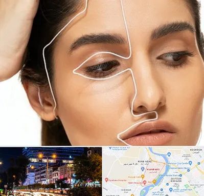 عمل بینی اقساطی در کیانپارس اهواز