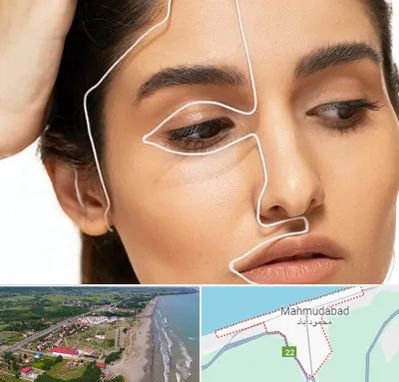 عمل بینی اقساطی در محمودآباد