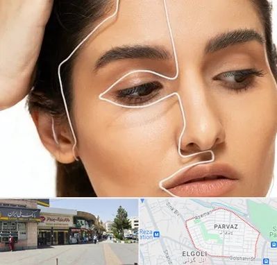 عمل بینی اقساطی در پرواز تبریز