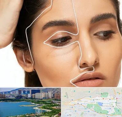 عمل بینی اقساطی در منطقه 22 تهران 