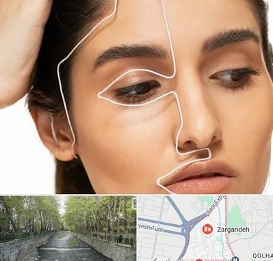 عمل بینی اقساطی در زرگنده