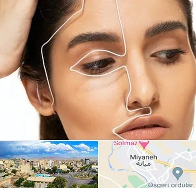 عمل بینی اقساطی در میانه