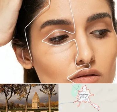 عمل بینی اقساطی در تویسرکان