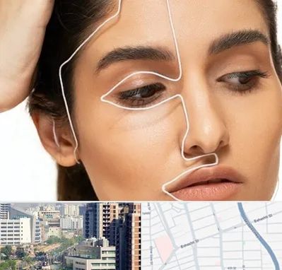 عمل بینی اقساطی در خیابان بهشتی