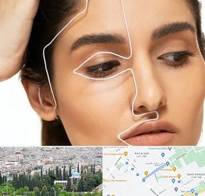 عمل بینی اقساطی در محلاتی شیراز