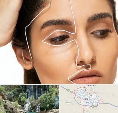 عمل بینی اقساطی در شیروان