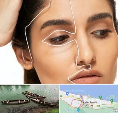 عمل بینی اقساطی در بندر انزلی