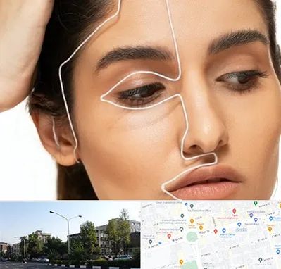 عمل بینی اقساطی در میدان کاج 