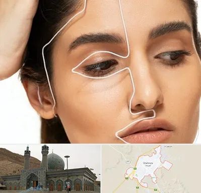 عمل بینی اقساطی در شهرضا