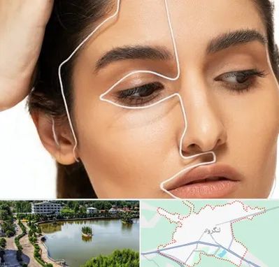 عمل بینی اقساطی در لنگرود