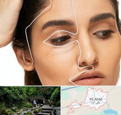 عمل بینی اقساطی در علی آباد کتول