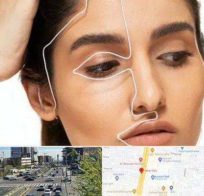 عمل بینی اقساطی در ستاری 