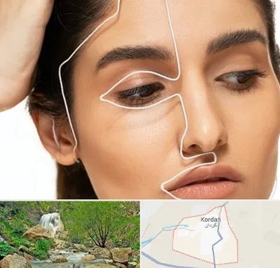 عمل بینی اقساطی در کردان
