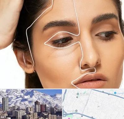 عمل بینی اقساطی در ازگل