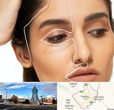 عمل بینی اقساطی در تایباد