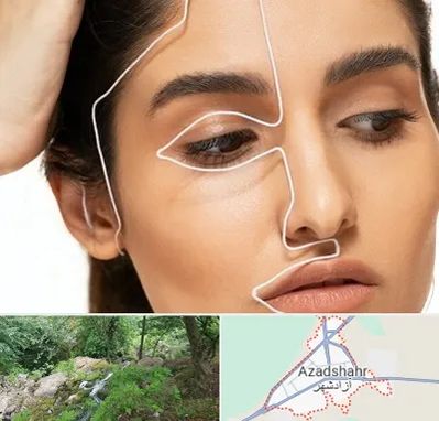 عمل بینی اقساطی در آزادشهر