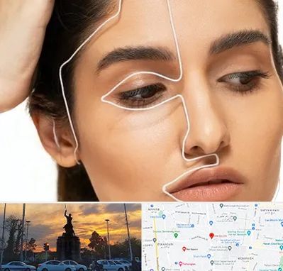 عمل بینی اقساطی در میدان حر 