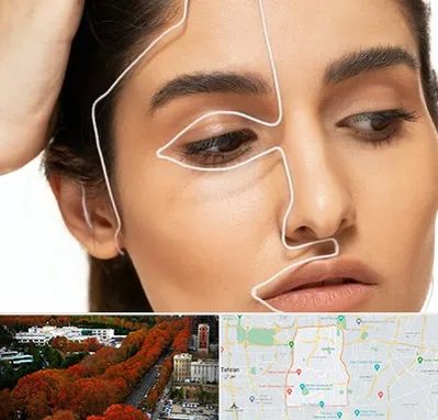 عمل بینی اقساطی در منطقه 6 تهران 