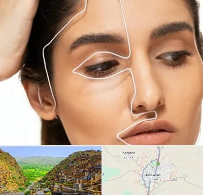عمل بینی اقساطی در کامیاران