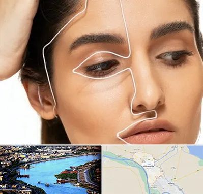 عمل بینی اقساطی در خرمشهر