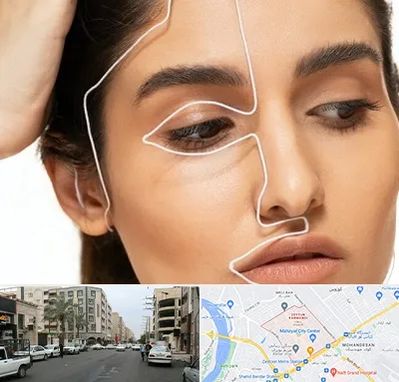 عمل بینی اقساطی در زیتون کارمندی اهواز