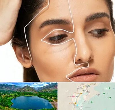 عمل بینی اقساطی در رودبار