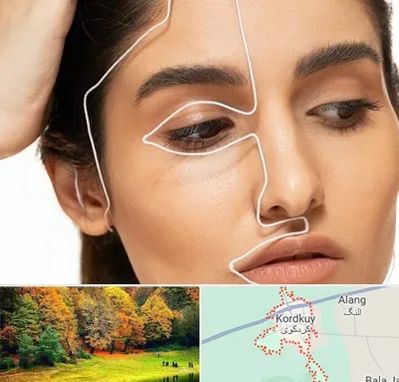 عمل بینی اقساطی در کردکوی