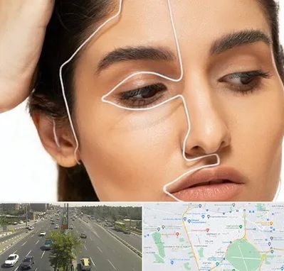 عمل بینی اقساطی در منطقه 17 تهران 