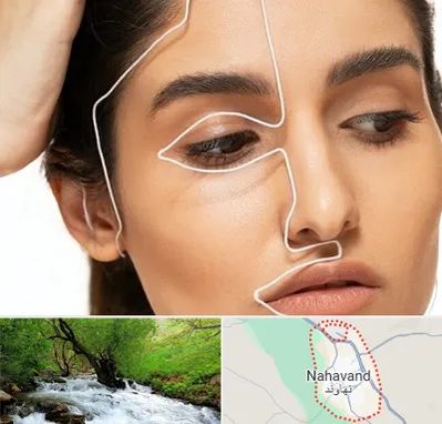 عمل بینی اقساطی در نهاوند