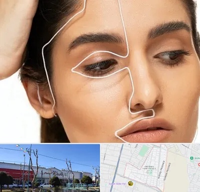 عمل بینی اقساطی در فاز دو اندیشه